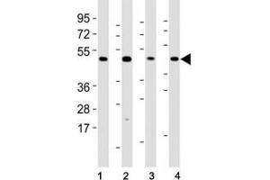 Western blot testing of Mlkl antibody at 1:2000 dilution and mouse samples: (1) lung, (2) NIH3T3, (3) liver, (4) testis lysate