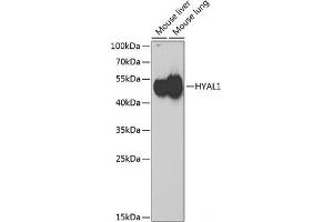Western blot analysis of extracts of various cell lines using HYAL1 Polyclonal Antibody at dilution of 1:1000. (HYAL1 抗体)