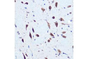 Immunohistochemistry of paraffin-embedded rat brain using hnRNP E2/PCBP2 Rabbit pAb (ABIN3023339, ABIN3023340, ABIN3023341 and ABIN6219620) at dilution of 1:100 (40x lens). (PCBP2 抗体  (AA 1-130))