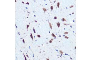 Immunohistochemistry of paraffin-embedded rat brain using hnRNP E2/PCBP2 Rabbit pAb (ABIN3023339, ABIN3023340, ABIN3023341 and ABIN6219620) at dilution of 1:100 (40x lens). (PCBP2 抗体  (AA 1-130))