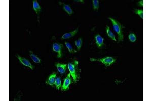 Immunofluorescent analysis of Hela cells using ABIN7169956 at dilution of 1:100 and Alexa Fluor 488-congugated AffiniPure Goat Anti-Rabbit IgG(H+L) (TAUT 抗体  (AA 1-49))