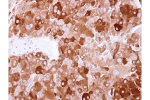 IHC-P Image LTBP4 antibody [N1N2], N-term detects LTBP4 protein at cytosol on human adrenal gland tumor by immunohistochemical analysis. (LTBP4 抗体  (N-Term))