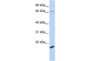 WB Suggested Anti-ZFP37 Antibody Titration:  0.