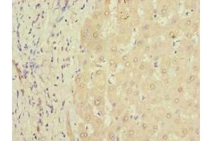 Immunohistochemistry of paraffin-embedded human liver tissue using ABIN7164073 at dilution of 1:100 (PQLC3 抗体  (AA 118-170))