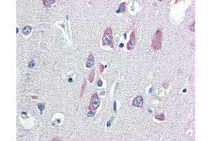 Anti-VPS25 antibody IHC of human brain, cortex.