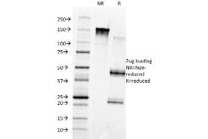 SDS-PAGE Analysis Purified Fibronectin Monoclonal Antibody (568). (Fibronectin 1 抗体)