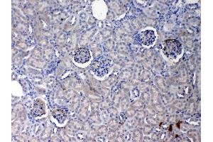 IHC analysis of Crp using anti- Crp antibody . (CRP 抗体  (AA 20-225))