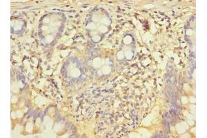 Immunohistochemistry of paraffin-embedded human small intestine tissue using ABIN7148943 at dilution of 1:100 (CCNJL 抗体  (AA 315-435))