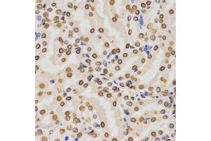 Immunohistochemistry (Paraffin-embedded Sections) (IHC (p)) image for anti-Histone 3 (H3) (H3K36me2) antibody (ABIN3016036)