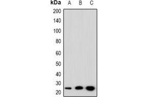 Western blot analysis of SFT2D3 expression in HepG2 (A), NIH3T3 (B), PC12 (C) whole cell lysates. (SFT2D3 抗体)