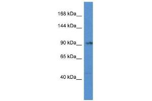 Western Blot showing Tnni3k antibody used at a concentration of 1. (TNNI3K 抗体  (Middle Region))