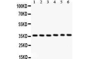 Anti- HMOX2 antibody, Western blotting All lanes: Anti HMOX2  at 0. (HMOX2 抗体  (AA 2-316))