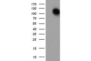 HEK293T cells were transfected with the pCMV6-ENTRY control (Left lane) or pCMV6-ENTRY ENPEP (Right lane) cDNA for 48 hrs and lysed. (ENPEP 抗体)