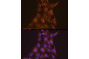 Immunofluorescence analysis of C6 cells using LIS1 Rabbit mAb (ABIN7269401) at dilution of 1:100 (40x lens). (PAFAH1B1 抗体)