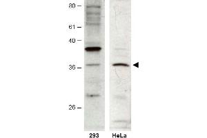 Image no. 1 for anti-HUS1 Checkpoint Homolog B (HUS1B) (AA 104-117) antibody (ABIN401265) (HUS1B 抗体  (AA 104-117))