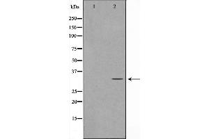 Western blot analysis on Jurkat cell lysate using MAST4 Antibody，The lane on the left is treated with the antigen-specific peptide. (MAST4 抗体  (N-Term))