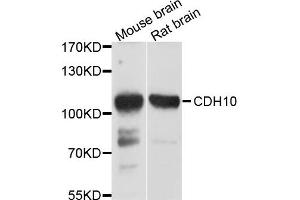 Western blot analysis of extract of mouse brain and rat brain cells, using CDH10 antibody. (CDH10 抗体)
