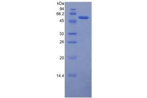 SDS-PAGE analysis of Human Ferroportin Protein. (SLC40A1 蛋白)