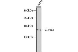 Western blot analysis of extracts of A-375 cells using CEP164 Polyclonal Antibody at dilution of 1:1000. (CEP164 抗体)