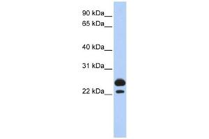 AK1 antibody used at 1 ug/ml to detect target protein. (Adenylate Kinase 1 抗体  (Middle Region))