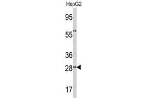 Western blot analysis of ORM1 antibody (C-term) in HepG2 cell line lysates (35ug/lane). (ORM1 抗体  (C-Term))