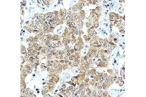 IHC analysis of ONECUT1 using anti-ONECUT1 antibody (ABIN7599190). (ONECUT1 抗体  (AA 1-270))