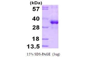 SDS-PAGE (SDS) image for Ribosomal Protein S3 (RPS3) (AA 1-243) protein (His tag) (ABIN667963) (RPS3 Protein (AA 1-243) (His tag))