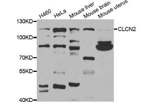Western Blotting (WB) image for anti-Chloride Channel 2 (CLCN2) antibody (ABIN1877106) (CLCN2 抗体)