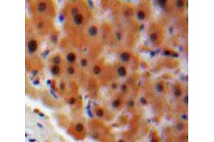 IHC-P analysis of Liver tissue, with DAB staining. (STAT2 抗体  (AA 616-849))