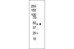 Western Blotting (WB) image for anti-Phosphatidylinositol-5-Phosphate 4-Kinase, Type II, alpha (PIP4K2A) (AA 303-335), (C-Term) antibody (ABIN392598)