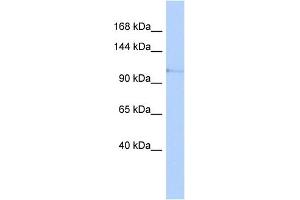 WB Suggested Anti-TLR5 Antibody Titration: 0. (TLR5 抗体  (N-Term))