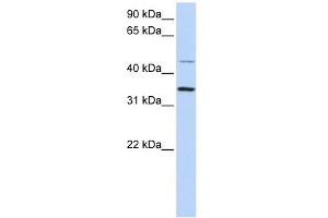 CLN6 antibody used at 1 ug/ml to detect target protein. (CLN6 抗体  (C-Term))