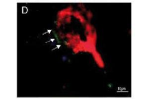 Immunofluorescence image of zonulin staining in cryosection of astrocytoma WHO III. (Zonulin 抗体)