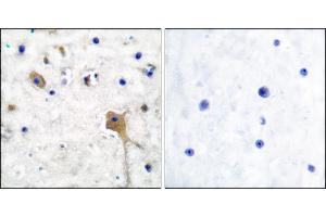 Immunohistochemical analysis of paraffin-embedded human brain tissue using SH-PTP2 antibody. (PTPN11 抗体)