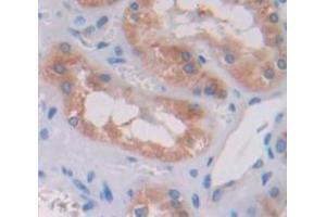 Used in DAB staining on fromalin fixed paraffin- embedded Kidney tissue (TRIP6 抗体  (AA 279-476))