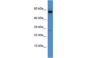 Host: Rabbit Target Name: CASP10 Sample Type: HCT15 Whole Cell lysates Antibody Dilution: 1. (Caspase 10 抗体  (C-Term))