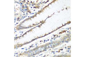 Immunohistochemistry of paraffin-embedded human stomach using CAD antibody (ABIN5974557) at dilution of 1/100 (40x lens). (CAD 抗体)