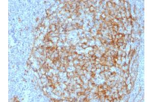 Formalin-fixed, paraffin-embedded human Lymph Node stained with CD14 Mouse Monoclonal Antibody (LPSR/2408). (CD14 抗体  (AA 25-148))
