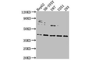 Western Blot Positive WB detected in: HepG2 whole cell lysate, SH-SY5Y whole cell lysate, U87 whole cell lysate, U251 whole cell lysate, 293 whole cell lysate All lanes: LRTM2 antibody at 1:2000 Secondary Goat polyclonal to rabbit IgG at 1/50000 dilution Predicted band size: 42 kDa Observed band size: 42 kDa (LRTM2 抗体  (AA 36-310))