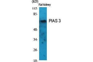 Western Blot (WB) analysis of specific cells using PIAS 3 Polyclonal Antibody. (PIAS3 抗体  (N-Term))