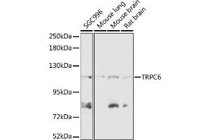 Western blot analysis of extracts of various cell lines, using TRPC6 antibody (ABIN7270918) at 1:1000 dilution. (TRPC6 抗体  (AA 732-931))