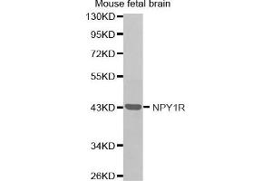 Western Blotting (WB) image for anti-Neuropeptide Y Receptor Y1 (NPY1R) antibody (ABIN3017402) (NPY1R 抗体)