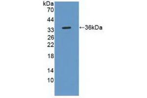 Western blot analysis of recombinant Human ROS1. (ROS1 抗体  (AA 1945-2222))