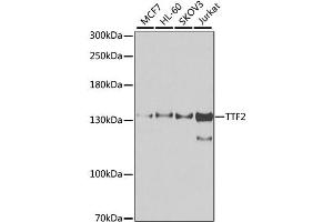 Western blot analysis of extracts of various cell lines, using TTF2 antibody. (TTF2 抗体)