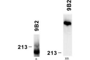Reactivity of laminin alpha4 chain specific monoclonal antibody 9B8 on human platelet lysate by Western blotting (reducing, R and nonreducing, NR conditions). (LAMa4 抗体)