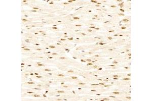 Immunohistochemistry (Paraffin-embedded Sections) (IHC (p)) image for anti-Glutathione S-Transferase theta 1 (GSTT1) antibody (ABIN7074091)