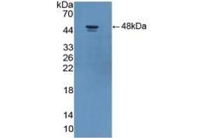 Detection of Recombinant ADIPOR2, Human using Polyclonal Antibody to Adiponectin Receptor 2 (ADIPOR2) (Adiponectin Receptor 2 抗体  (AA 2-155))