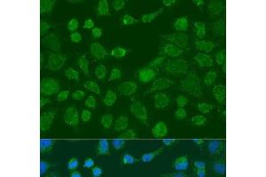 Immunofluorescence analysis of U2OS cells using WNT9A Polyclonal Antibody at dilution of 1:100. (WNT9A 抗体)