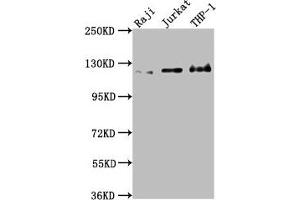 Western Blot Positive WB detected in: Raji whole cell lysate, Jurkat whole cell lysate, THP-1 whole cell lysate All lanes: MICAL1 antibody at 1:2000 Secondary Goat polyclonal to rabbit IgG at 1/50000 dilution Predicted band size: 118, 109, 38, 120 kDa Observed band size: 120 kDa