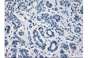 Immunohistochemical staining of paraffin-embedded breast tissue using anti-CYP2E1 mouse monoclonal antibody. (CYP2E1 抗体)